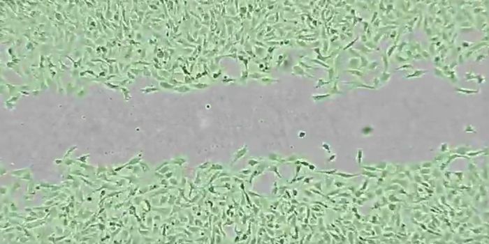 Cell Movement Increases as Interactions Increase, Contrary to Assumptions