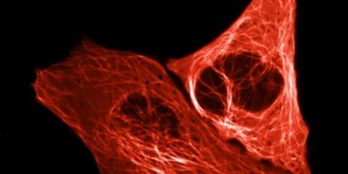 Introducing mScarlet - a Bright Red Fluorescent Protein