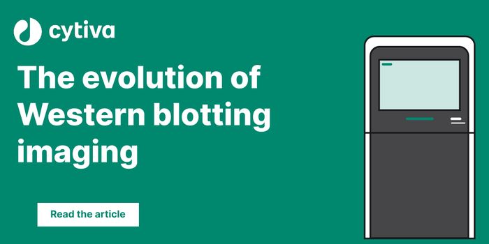 The evolution of Western blotting imaging