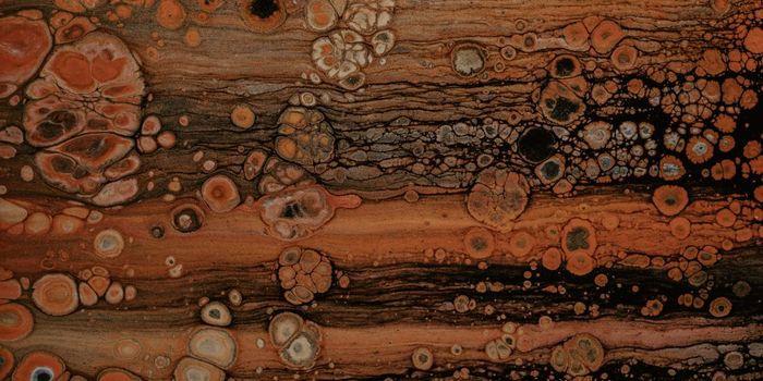 Cannabis May Relieve Pain from Sickle Cell Disease