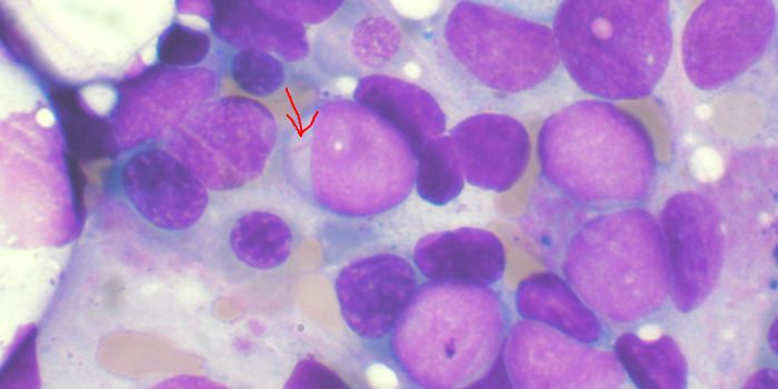 Blood Cancer is Actually Made Up of 11 Subtypes