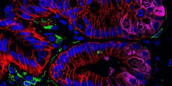 The Microbiome is Affected by the Genome of Its Host