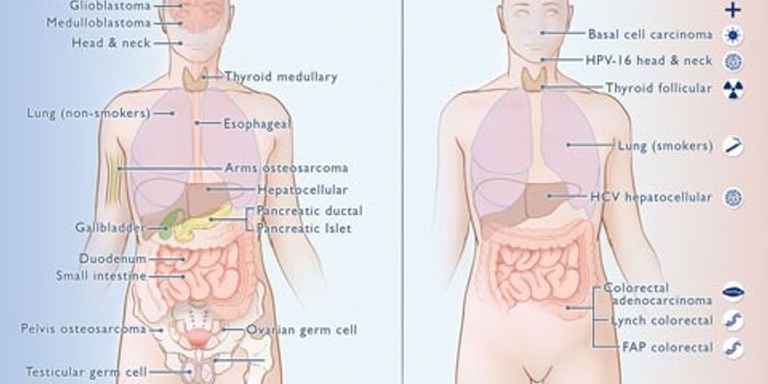 Bad Luck May Play Key Role in Cancer Developing in Some Tissues: Researchers unravel why certain tissues spur cancers more frequently than other types