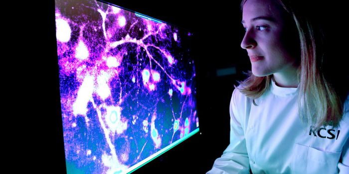 Finding a Way to Predict Epileptic Seizures