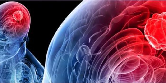 Key Genetic Defect in Brain Tumor Cells