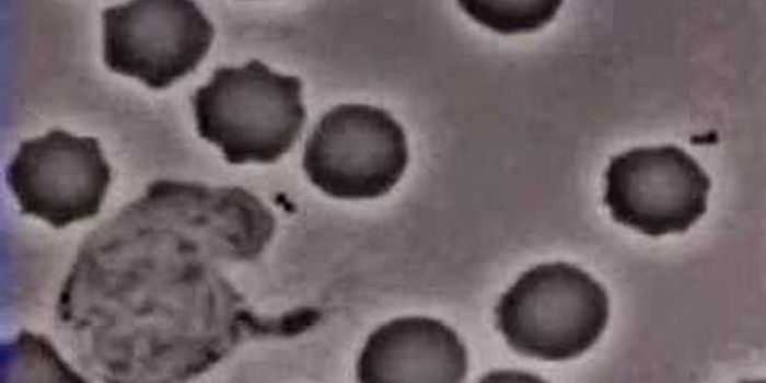 Macrophage chasing down a bacterium