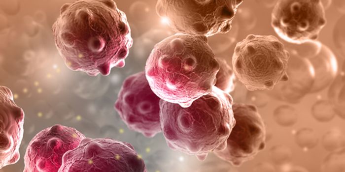 Risk of Breast, Ovarian Cancer May Differ By Type of BRCA1, BRCA2 Mutation: Study