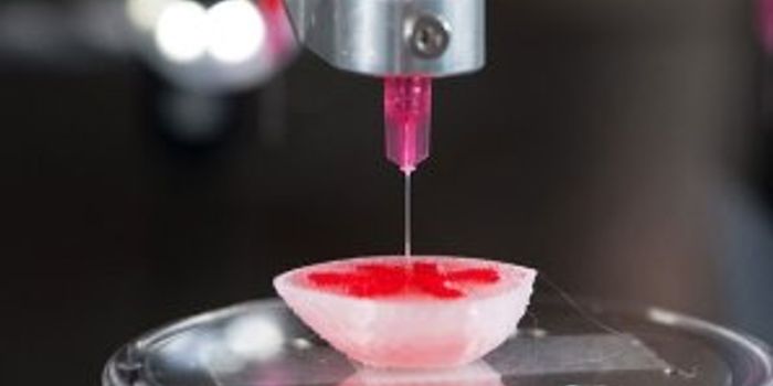 How Many Copies of That Kidney Would You Like?