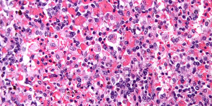 Two Proteins Play Unexpected Role in Immune System Regulators