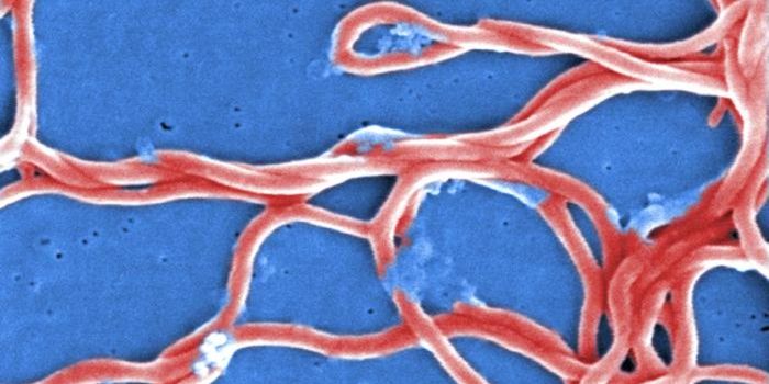 Researchers Find a Lyme Disease Diagnostic & Treatment Target