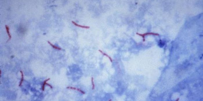 Blood-Based Biomarkers Could Enable Accurate TB Tests for Diagnosis