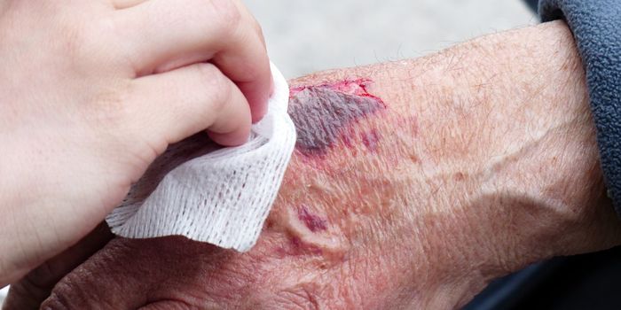 Multi-Purpose Immune Cells Heal Diabetic Wounds