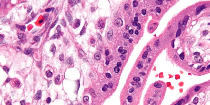 New Work Suggests How Zika May Infect the Fetus