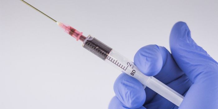 Testing the Immune Response to Ovarian Cancer Treatment