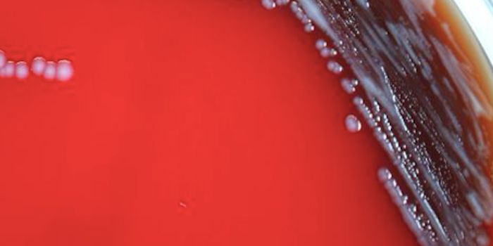 The CDC's Plan to Combat 'Nightmare' Bacteria