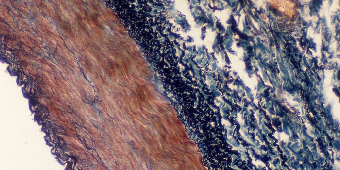 New Biomarker Improves Combination Cancer Therapy