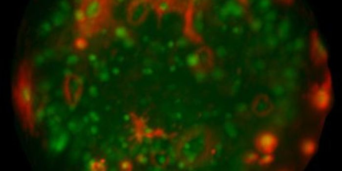 Planaria Development Aids Understanding of Regeneration