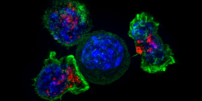 Rare Immune Cells Prevent Cancer from Spreading