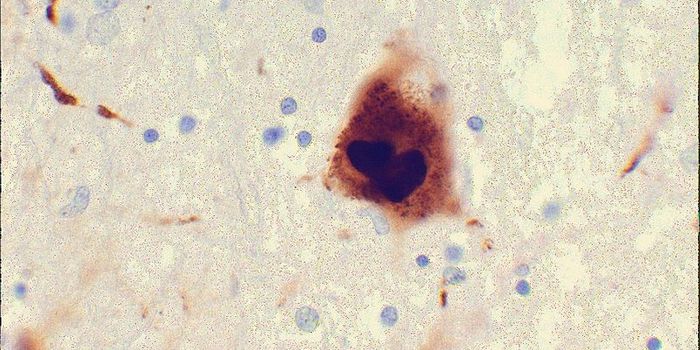 Enzyme's Structure Linked to Heart Disease, Diabetes, Cancer, Parkinson's