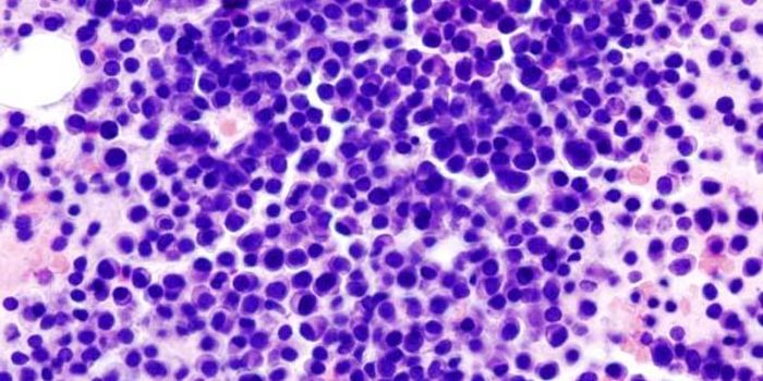 Understanding of Cancer Cell Enzyme Flipped on its Head