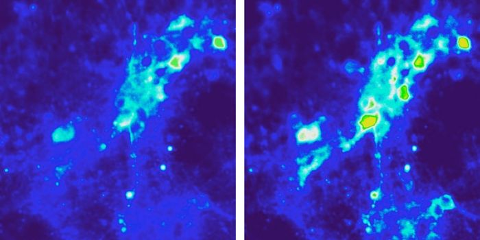 Magnetic Brain Stimulation