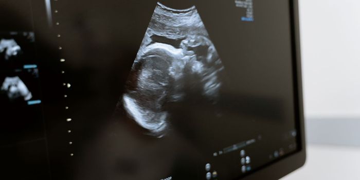 Senate Bill 8 Increases Demand for Birth Control