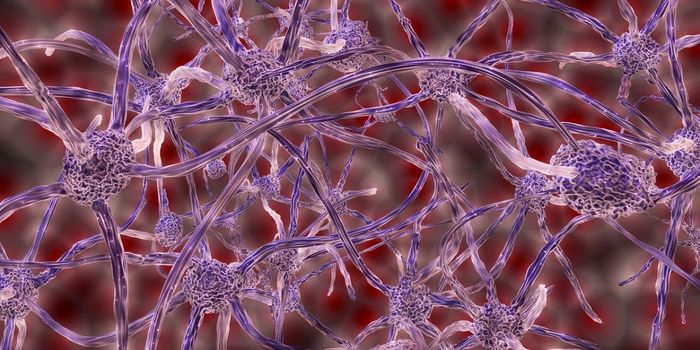 Ultrasound Boosts Drug Delivery to Deadly Brain Tumor