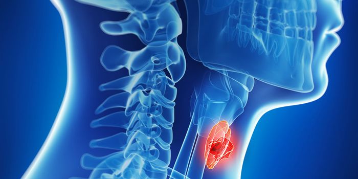 Aspirin-Like Drug Prevents Progression of Head and Neck Cancer