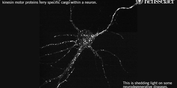 Imaging Tool Provides New Insight Into How Proteins are Moved in Cells