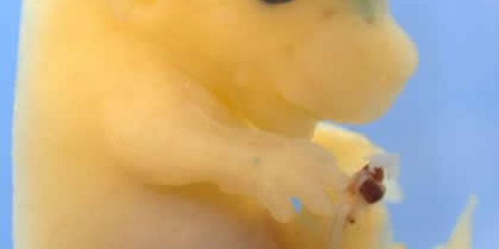 Evolving a Bigger Brain with Human DNA