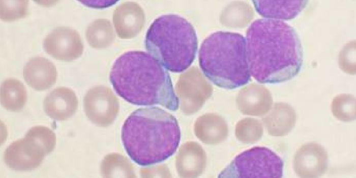 CAR T-Cell Immunotherapy on the Cusp of FDA Approval