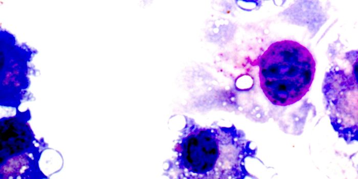 Resolving Immune Confliction to Battle Cancer