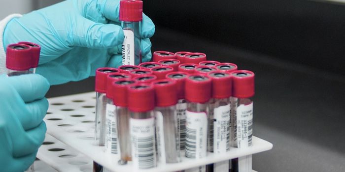 A Faster, Better Way to Diagnose Lyme Disease