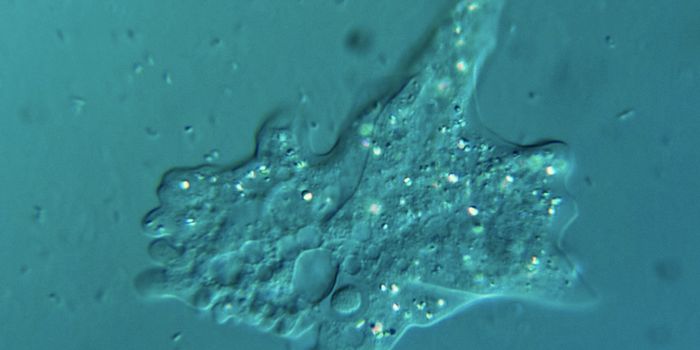 Histones May Be Essential to Amoeba-Infecting Viruses