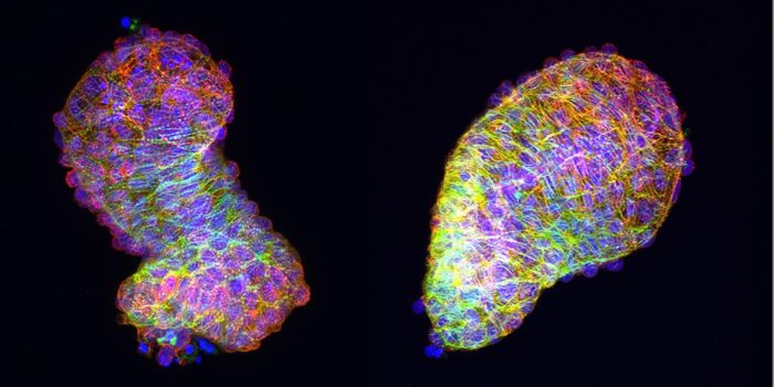 What the Zebrafish Heart Says About Congenital Heart Defects