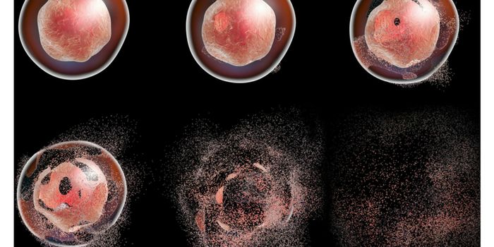 Synthetic Retinoid Shows Promise for Inhibition of Cancer Cells