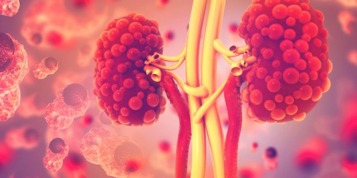 Understanding Why High Salt Diets Can Damage the Kidneys