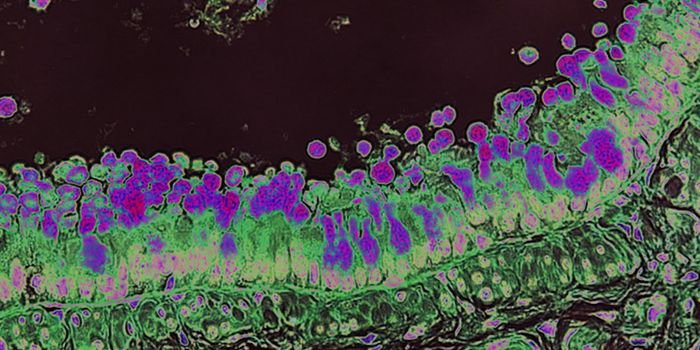 A Dietary Fiber Can Affect the Microbiome & Trigger Inflammation