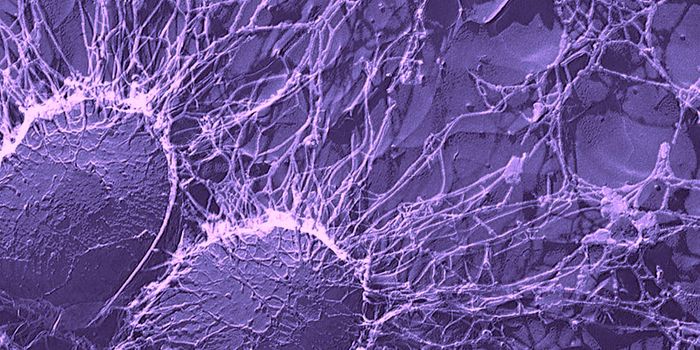 Study Shows How a Modified Microbiome Causes Obesity