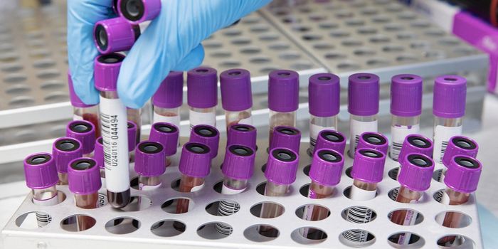 New Blood Test Can Diagnose Multiple Cancers, Even at Early Stages