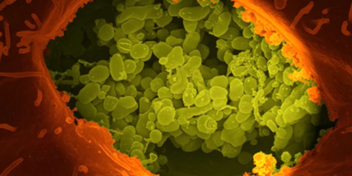 Mucus Eating Microbe Contributes to Major Cancer Treatment Complication