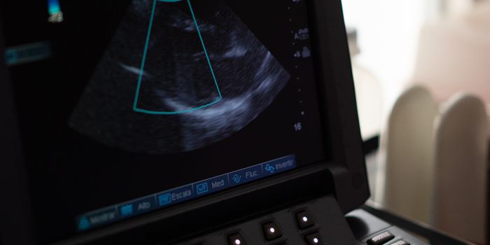 Echocardiogram May Help Predict COVID-19 Patients at Risk for Heart Complications
