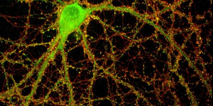 These Two Molecules Appear to Drive Breast Cancer Drug Resistance