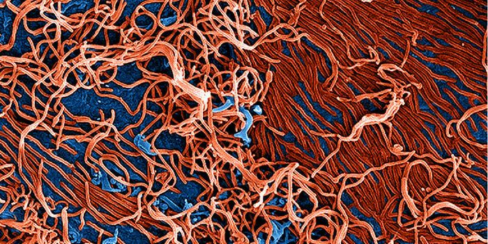 Ebola Virus Doesn't Infect Immune Cells, But It Does Kill Them