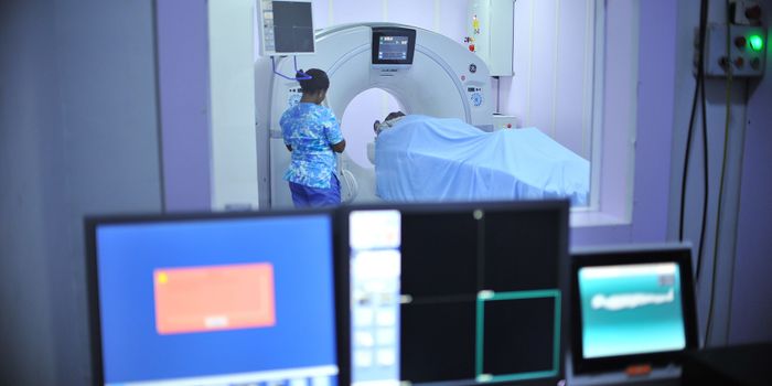 New Immunotherapy Targets Early-Stage Prostate Cancer