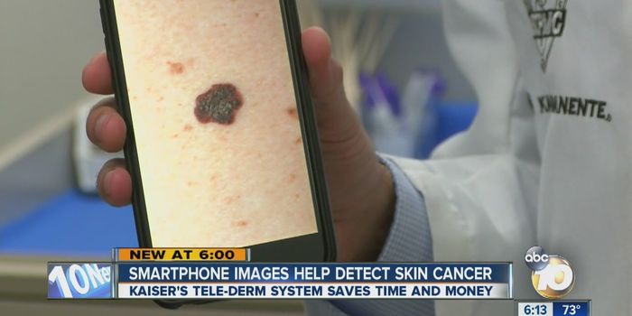 Selfies, Smartphones and Skin Cancer