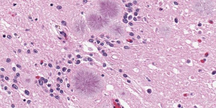 What Infectious Proteins Do in the Brain