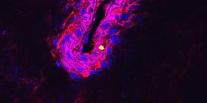 Antimicrobials may Stop Sepsis in Pneumonia Patients