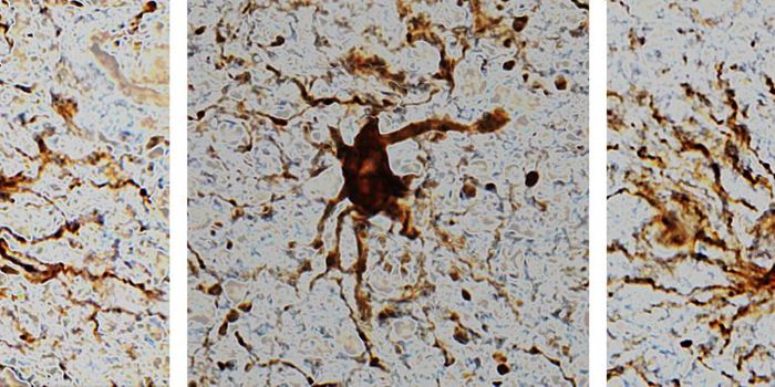Some 'Zombie' Genes Ramp Up Activity in the Brain After Death