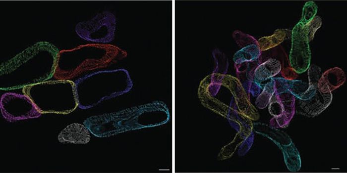 Excess Fat in the Heart Interferes with Energy Production